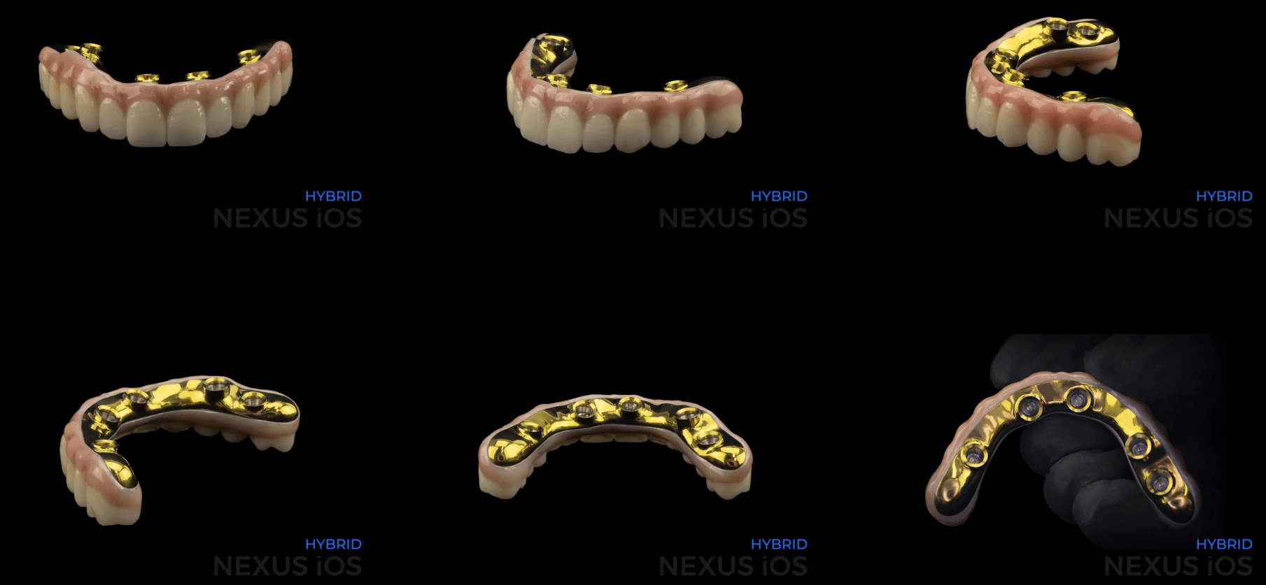 Nexus Hybrid